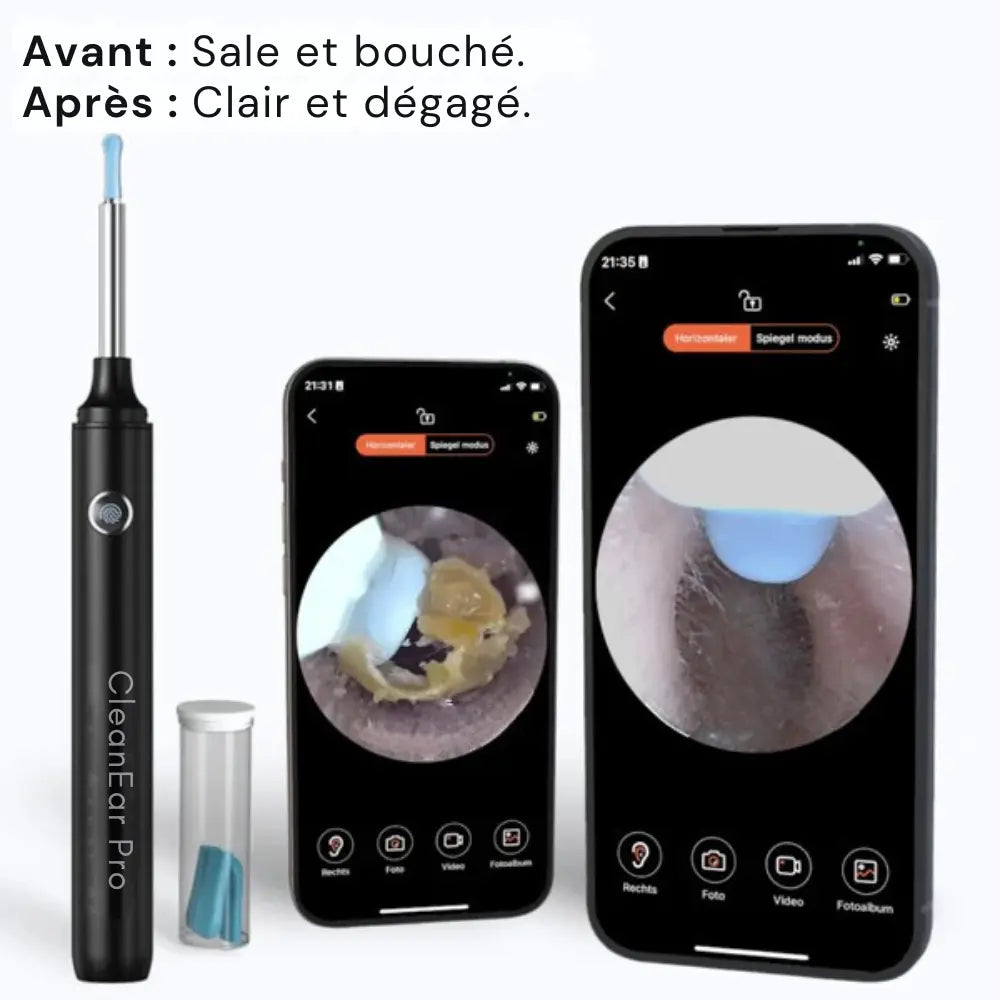 CleanEar Pro™ | Hygiène auriculaire High tech avec vision totale