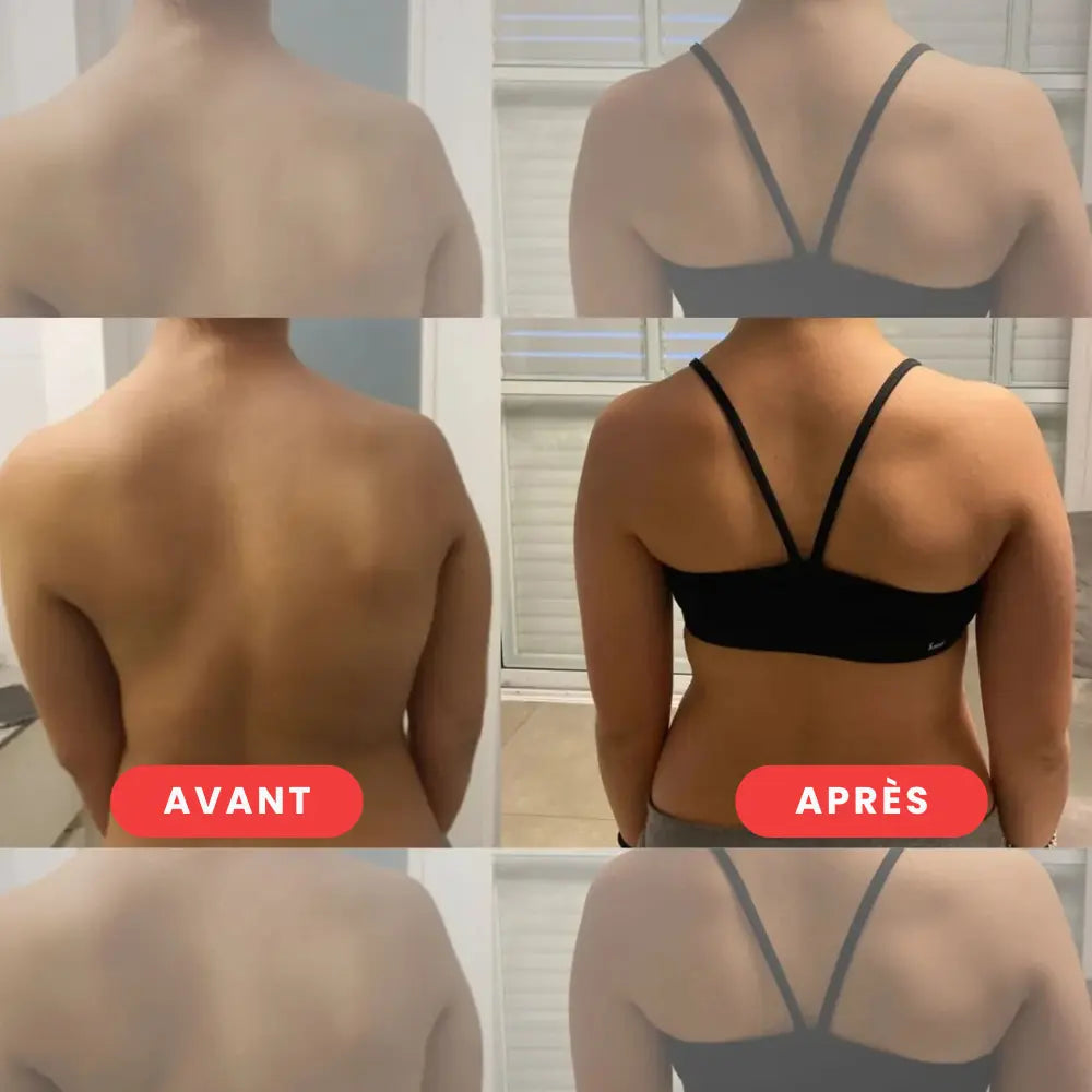 AlignFlex™ | Le correcteur pour une posture parfaite